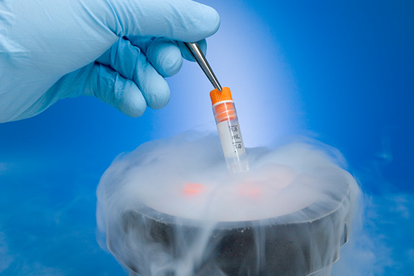 Embryo Freezing