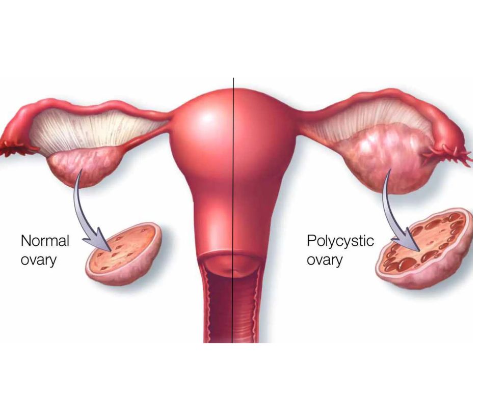 best ivf hospital in kompally