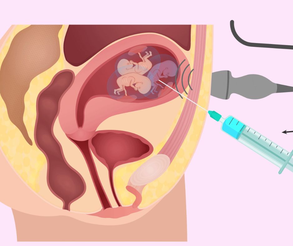 Best Fertility Hospital in Hyderabad